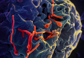 Should the U.S. Institute A Travel Ban to Deal Effectively With Ebola? Photo:NIAID